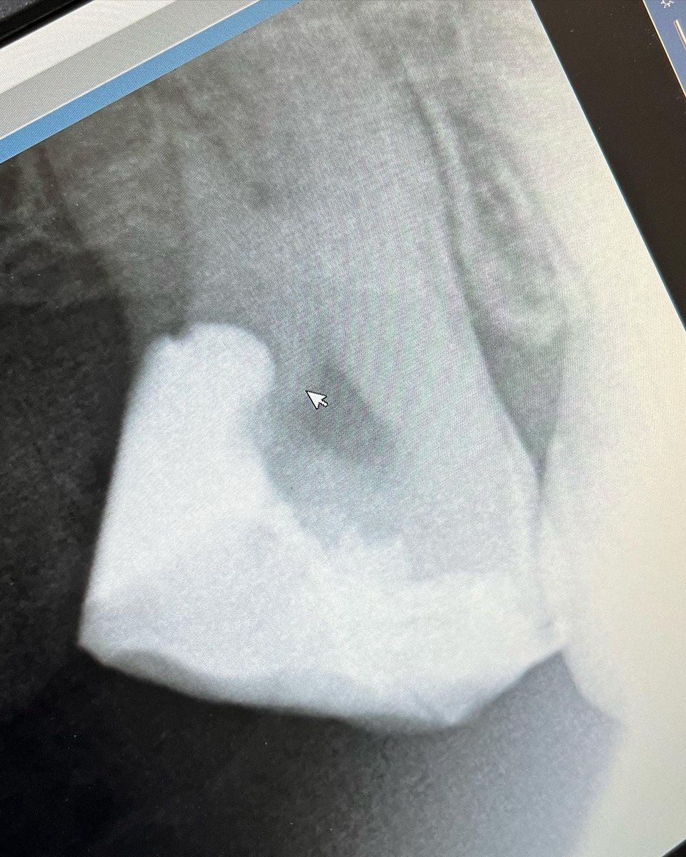 احتاج ميدالية على هالحشوة .. 😂