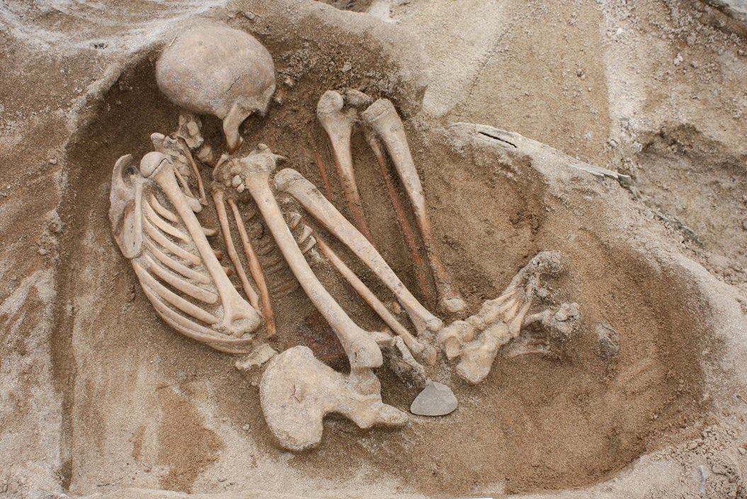 sasysquatchgirl's tweet photo. “The bones were carefully preserved and put together, when it was found to be of extraordinary height and proportions,” wrote author Horace Keach in, “Burrillville; As it Was, and as it is” – a book published in 1856.
The body was found “lying upon the side, with arms folded up, head bent forward, and the knees drawn upward.”
After the relic was exhumed, and the pieces put together, everyone gazing upon the figure was amazed at the height.
The unusual find “excited the wonderment of all the surrounding neighborhood,” according to, “History of the State of Rhode Island also printed it in 1878 by Albert J. Wright.
Serendipitously, one of White’s neighbors was a physician.
Dr. Levi Eddy examined the bones, proclaiming about the deceased person, “He was a bouncer! He must have been as much as eight feet high.”
About the relic, “imagination can only conjecture him as some giant of the forest that roamed the rude wilds, long, perhaps, before the Pilgrim Fathers landed at Plymouth,” wrote Keach.
At that time it was speculated the remains were that of a Native American, perhaps a ruler.
#giants #folklore #FolkloreThursday