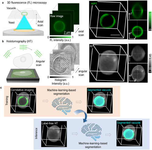 Introducing our hybrid machine-learning framework for precise evaluation of intracellular organelles in 3D imaging! 🧬

 We delved deep into live budding yeast cells 🦠, unveiling segmentation of vacuoles &amp; quantifying biophysical parameters.

 opg.optica.org/boe/fulltext.c…