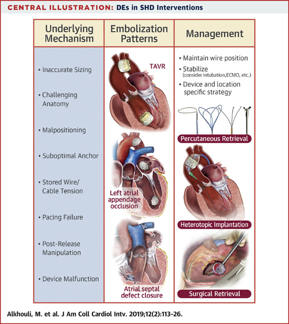 Device Embolization in Structural Heart Interventions: Incidence, Outcomes, and Retrieval Techniques | JACC_Intervention

@JACCJournals #StateOfTheArt📝#CardioTwitter 

🔗➡️sciencedirect.com/science/articl…