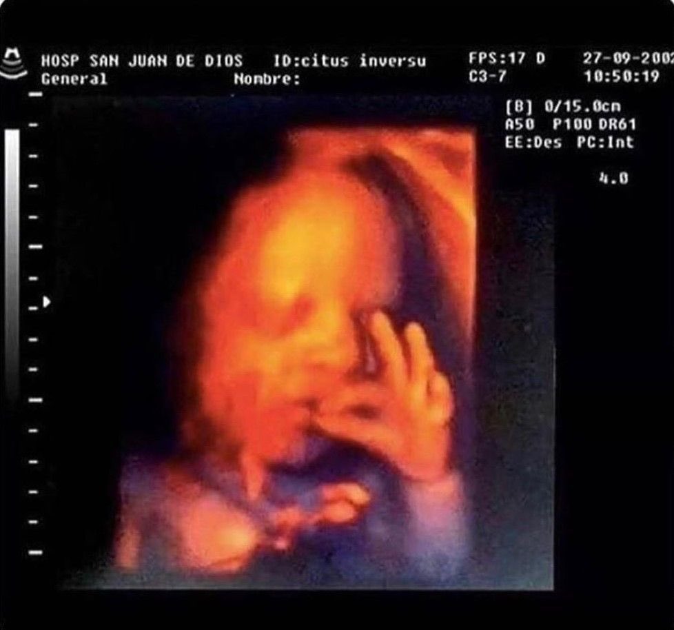 mi madre m ha enseñado una foto mia en su barriga