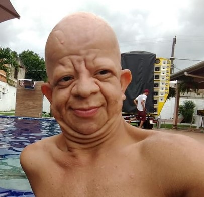 Bruno Diferente (Bald Guy)