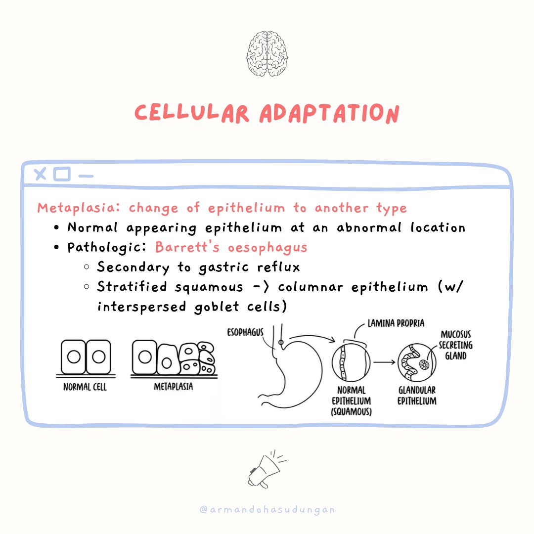 armandohasudung's tweet photo. Cellular adaptation is the ability of cells to respond to various types of stimuli and adverse environmental changes.
Watch the full video here: https://t.co/pCNtDct9Dy
#cellularadaptation #metaplasia #barrettsesophagus #medicalcommunication #armandohasudungan #medicaleducation https://t.co/aMBbEm5dmM