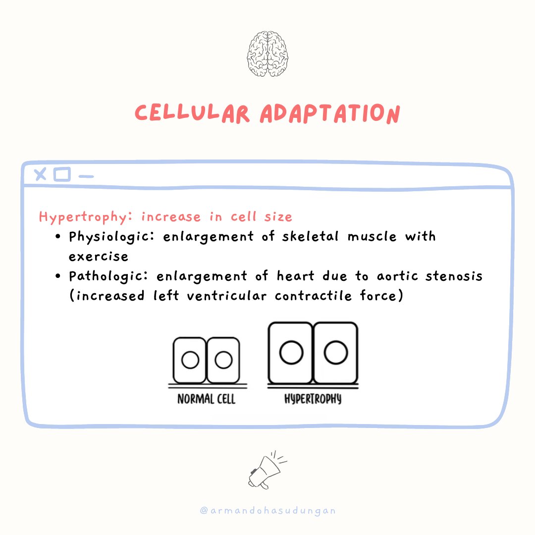 armandohasudung's tweet photo. Cellular adaptation is the ability of cells to respond to various types of stimuli and adverse environmental changes.
Watch the full video here: https://t.co/pCNtDct9Dy
#cellularadaptation #metaplasia #barrettsesophagus #medicalcommunication #armandohasudungan #medicaleducation https://t.co/aMBbEm5dmM