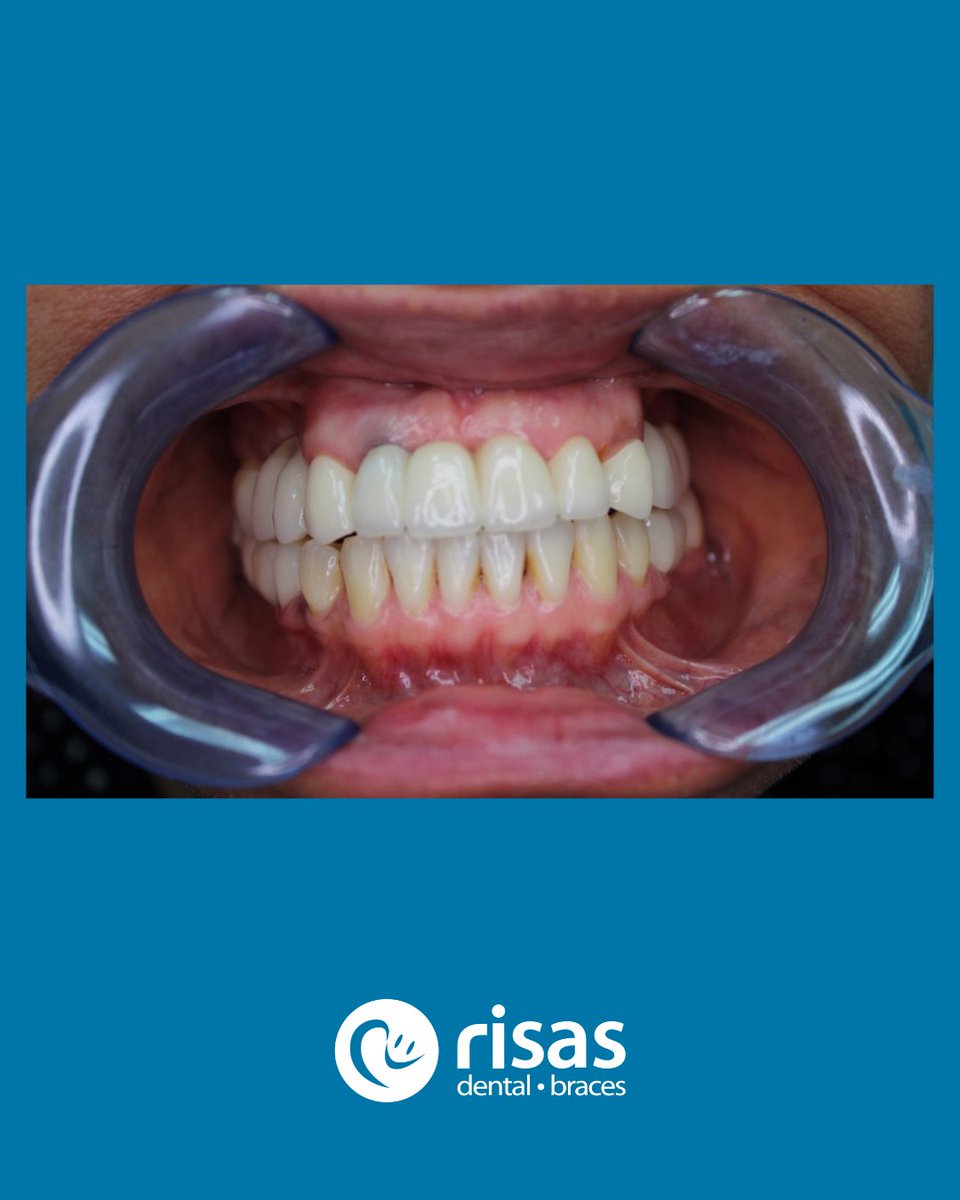 Check out the the heartfelt message we received about one of this year's Mother's Day Dental Makeover winners and see her beautiful new #RisasSmile 😍 

Maria's dental makeover included 5 bridges, 2 extractions, and fillings totaling over $21,000 of FREE dental care! 🦷