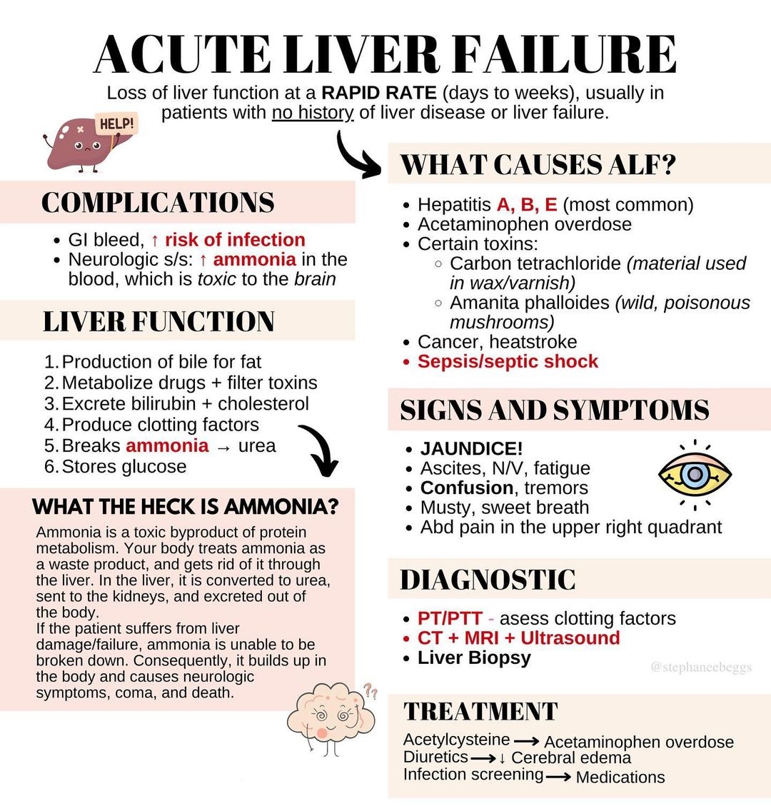 ManualOMedicine's tweet photo. Acute Liver Failure

by @StephaneeBeggs

#medtwitter #foamed #meded https://t.co/efR4NqgIf9