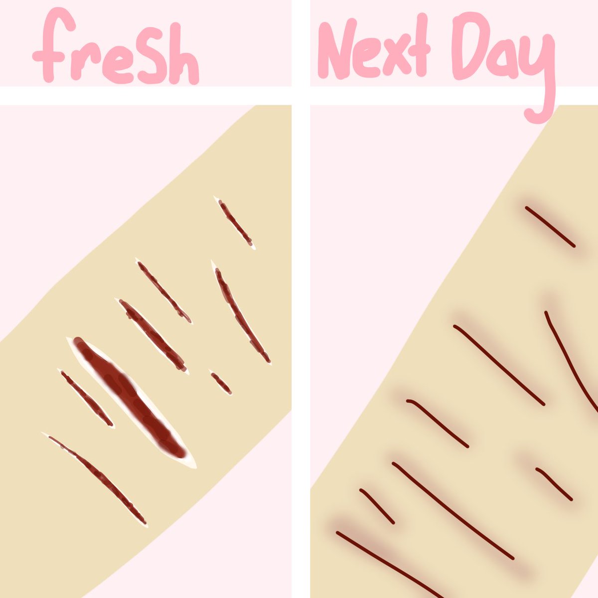 dottedxribbon's tweet photo. Does this happen to anyone else? Tw: self harm https://t.co/XjUmccI15v
