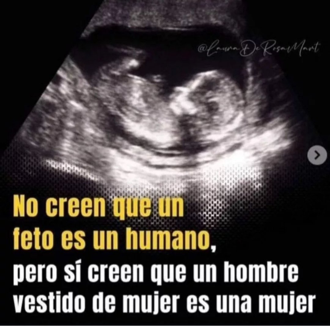 La ideología de género es antinatura. Respeto las preferencias sexuales de cada quien, pero imposible que la autopercepción genere derecho alguno. 
Los derechos no se originan por los gustos sino por la condición humana.
Hay vida desde la concepción y existen solo dos sexos ♂️♀️