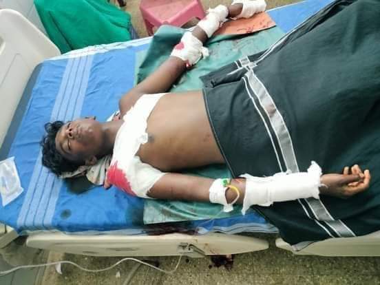 thirumaofficial's tweet image. நாங்குநேரி பெருந்தெரு ஆதிராவிடர் குடியிருப்பிற்குள் ஆயுதங்களோடு புகுந்து பனிரெண்டாம் வகுப்பு மாணவன் சின்னதுரை மற்றும் அவனது தமக்கை சந்திராதேவி ஆகியோர் மீது கொலைவெறித் தாக்குதல் நடத்தியவர்கள் சின்னதுரையுடன் படிக்கும் மாணவர்கள்தான் என்பது இளந்தலைமுறையினர் எவ்வாறு இங்கே…