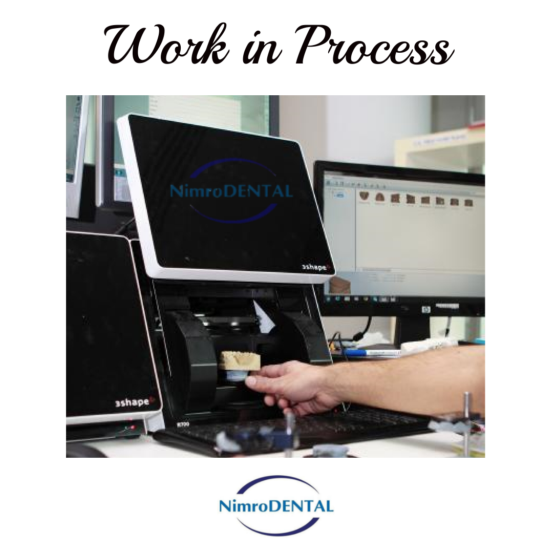 Nimrodental's tweet image. #scannerart
#dentallab #retainers #orthodontics #ortholab #orthodonticlab #dental #teeth #cadcam #cadcamdentistry #3shape #rme #straightteeth #denture #dentalcare #rapidmaxillaryexpansion #dentistlondon #centrallondon #expansionappliance #iloveortho #dentaltechnician #acrylic