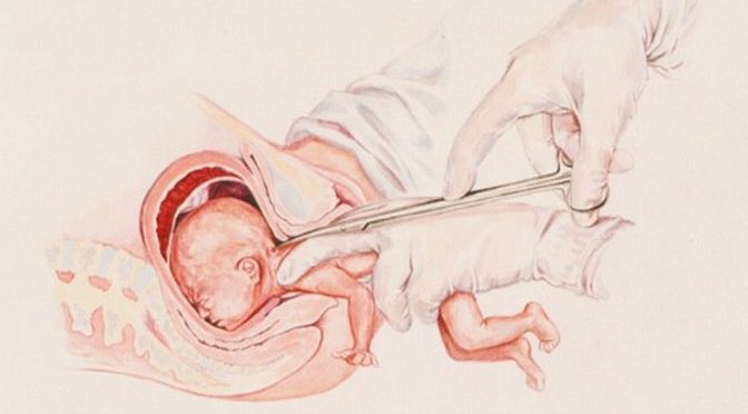 Roadmaster71's tweet photo. @TheDemocrats Biden issued ex. order to “safeguard access to reproductive health care.”

“CrookedBiden issued executive order to guarantee the death of millions more of unborn children by way of abortion.

I can say it. Why can’t  #Democrats say it?

Evil always hides behind lies.
Look hard! https://t.co/wsctq4AgBp