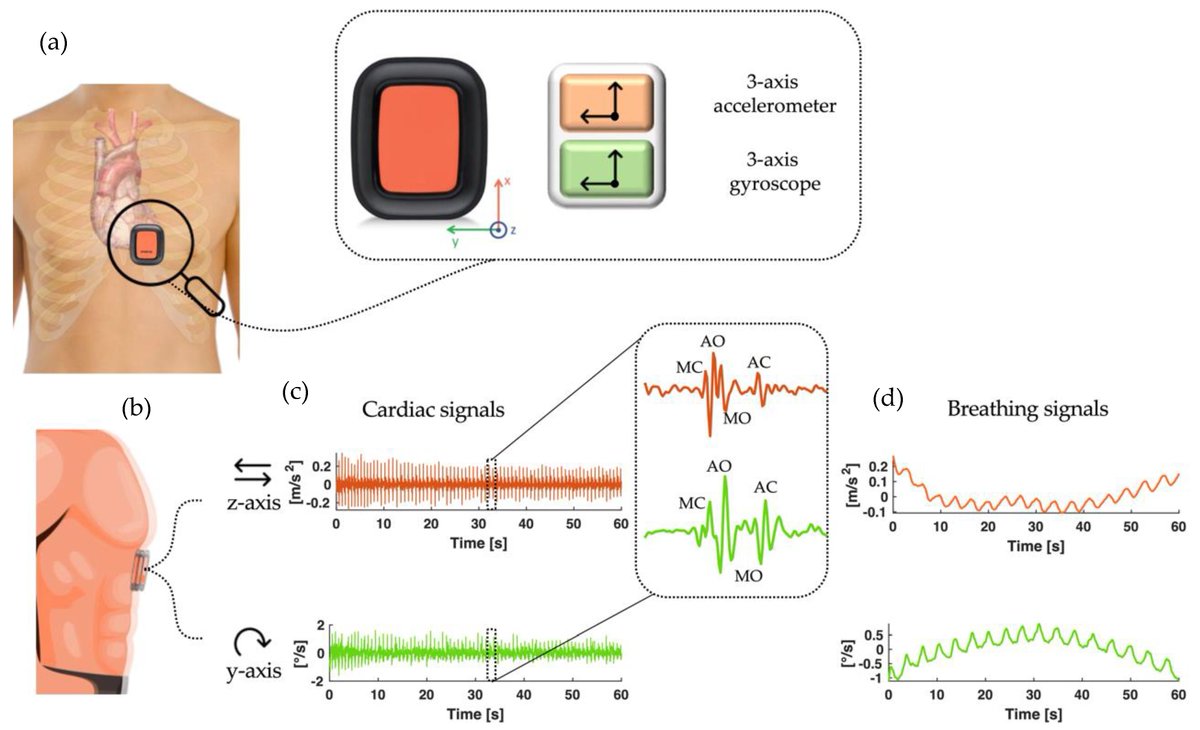 Biosensors_MDPI's tweet image. Article by Chiara Romano, et al.丨Comparison between Chest-Worn Accelerometer and Gyroscope Performance for Heart Rate and Respiratory Rate Monitoring
mdpi.com/2079-6374/12/1…

@mdpiopenaccess @CampusBioMedico @UniofNewcastle
#Accelerometer #Gyroscope #wearable #sensor #biomedical