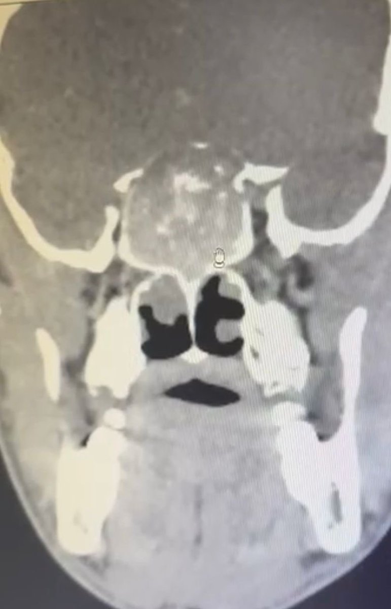 د.عبدالعزيز القحطاني tweet media