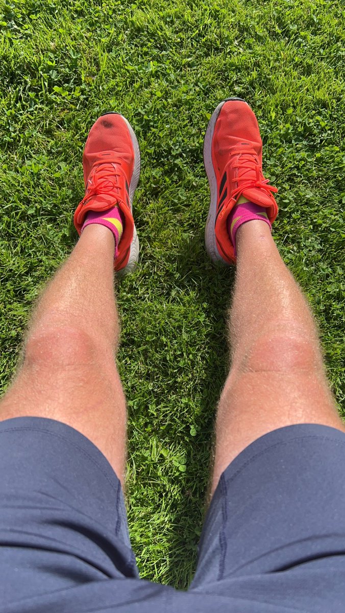 Legs out in the sun again.. I think I need to bin the trainers!