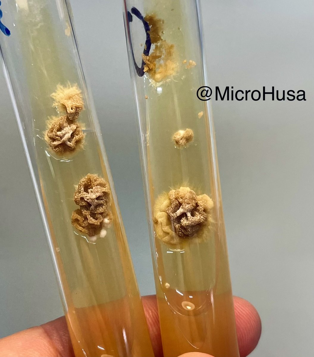 Epidermophyton floccosum en agar sabouraud dex. 🦠🧪

¡Se puede apreciar el aspecto de cerebro de la colonia! 🧠 

#FungiFriday #microbiology #FungalFriday #IDTwitter