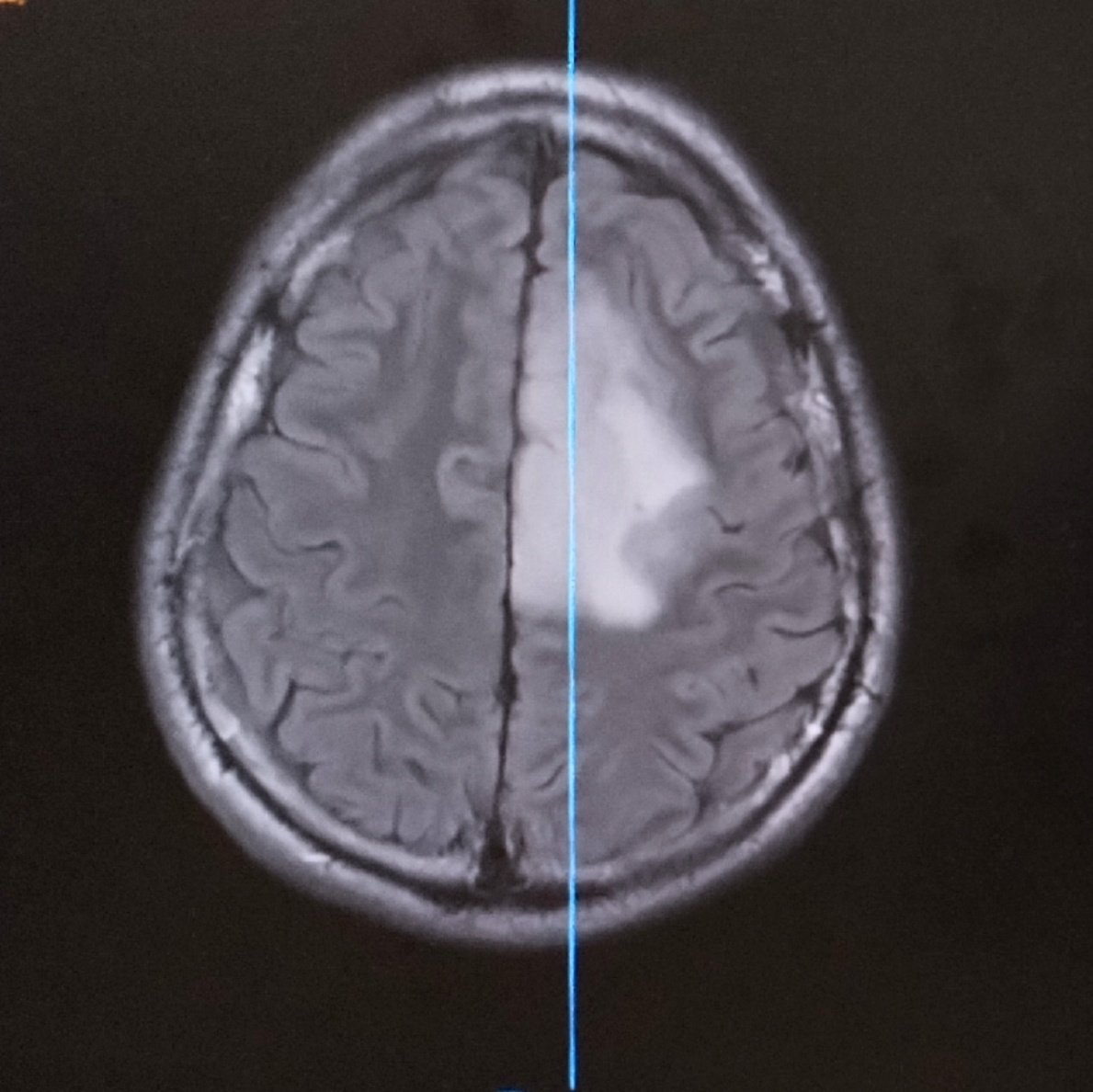 Jesus Ramirez-Bermudez tweet media