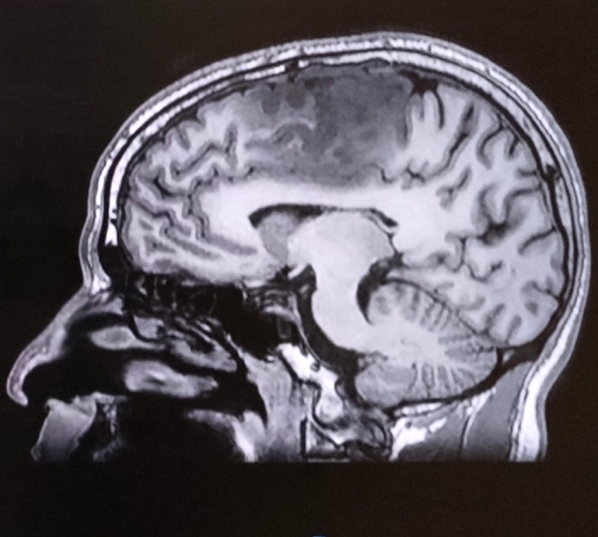 Jesus Ramirez-Bermudez tweet media