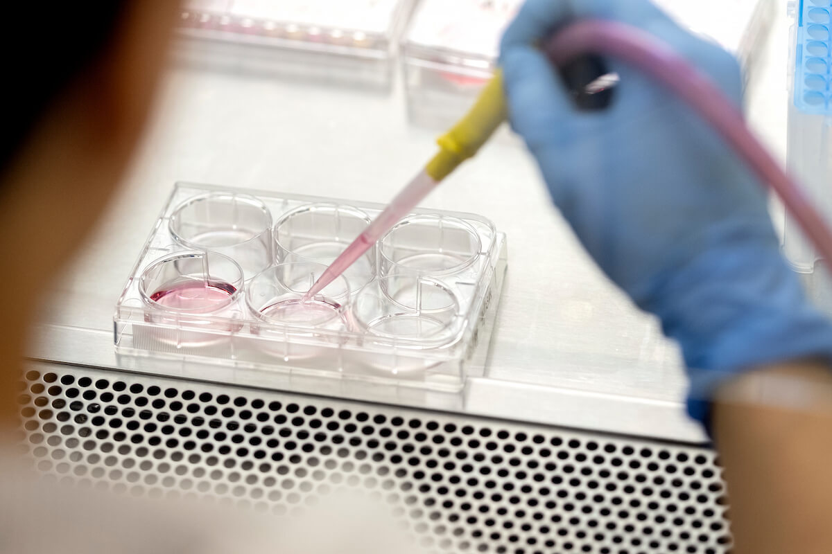 Lampe Joint Biomedical Engineering (@jointbme) on Twitter photo Three Joint Department researchers received R01 grants to investigate public health challenges ranging from kidney monitoring to wound healing and HIV therapy @BenhabbourLab <a href="/BrownLab_NCSU/">Ashley Brown</a> <a href="/GallippiLab/">Gallippi Ultrasound Lab</a>
Read more about their research goals: go.ncsu.edu/4yv5opz Three Joint Department researchers received R01 grants to investigate public health challenges ranging from kidney monitoring to wound healing and HIV therapy @BenhabbourLab <a href="/BrownLab_NCSU/">Ashley Brown</a> <a href="/GallippiLab/">Gallippi Ultrasound Lab</a>
Read more about their research goals: go.ncsu.edu/4yv5opz