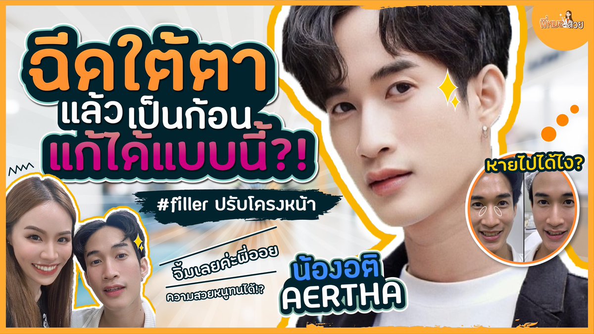 droilarunee's tweet photo. เบื้องหลังความสวยของดาราสาว @AerthH ✨🫶🏻 #ฟิลเลอร์ปรับโครงหน้า #พี่หมอพาสวย #romrawinclinic 

👉🏻 https://t.co/Y0wmZQBlLO https://t.co/Wsc6x6e7Mf