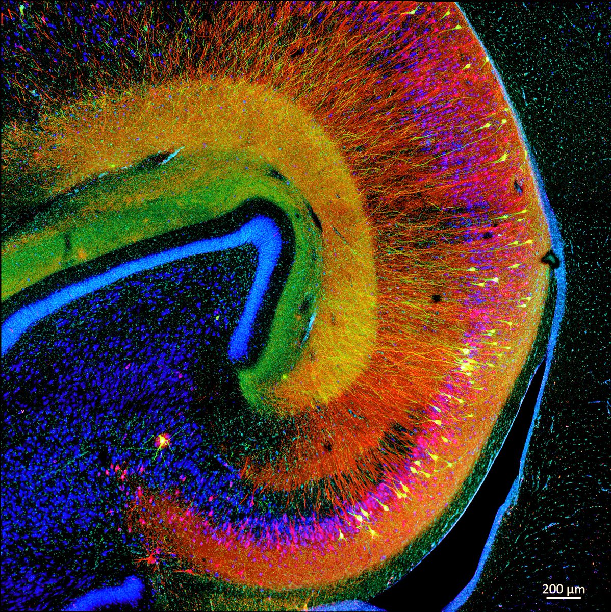 Colorful death: the image below is from our  #Alzheimer monkey model and shows neurons in different stages of cell death. Healthy cells in blue only. Markers: dapi (light🔵), pTau S422 (🔴), AT8 (🟢),  neun (dark🔵). <a href="/zeiss_micro/">ZEISS Microscopy</a> #neuroscience #FluorescenceFriday