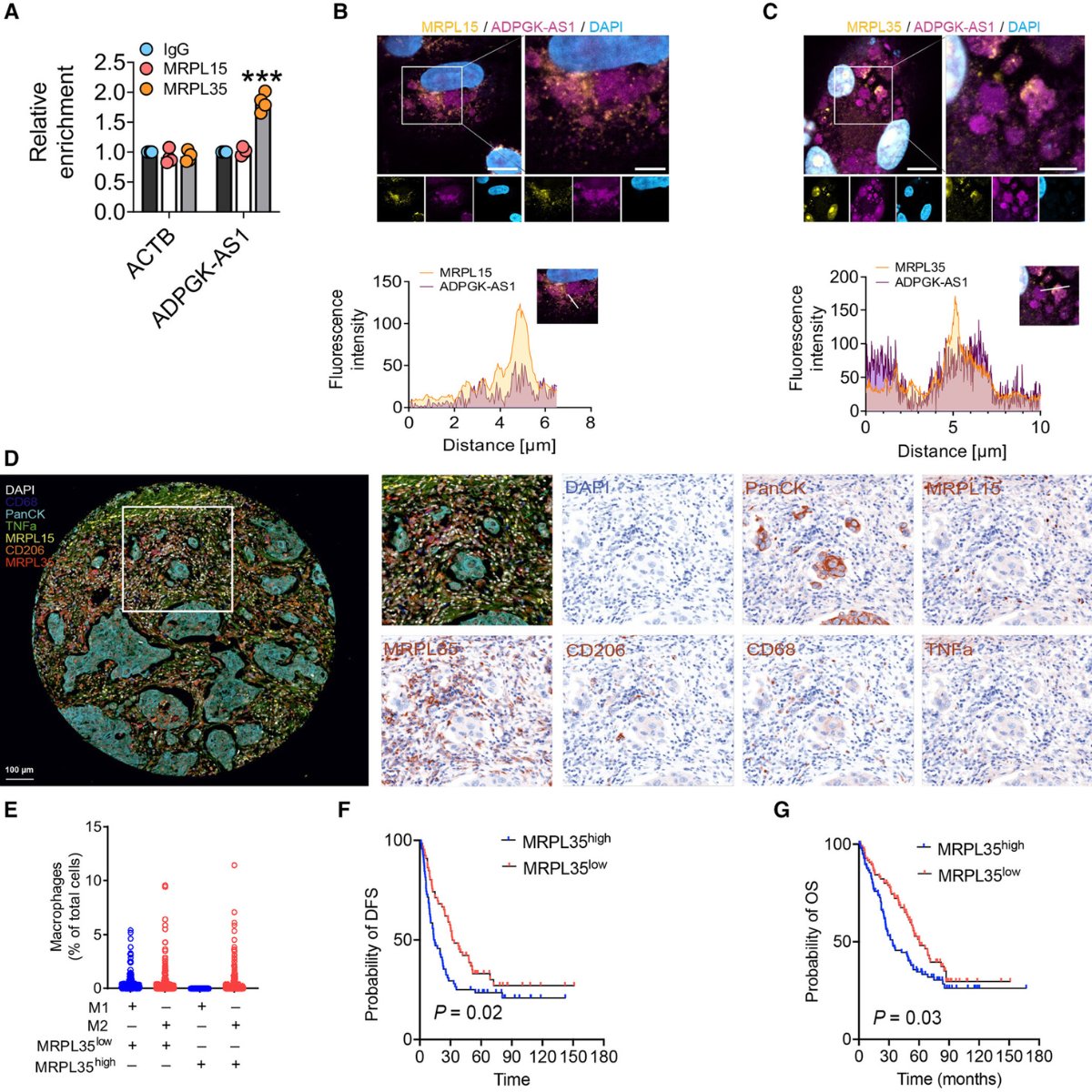 🔥 Hot off the press! This week, in the @embojournal, a paper discusses how researchers from Germany leverage the #PhenoImagerHT to elucidate the role of tumor-associated macrophages in #lungcancer. bit.ly/3OPkz1P 🎉 Congrats to @r_savai and co-authors! @Savai_Lab