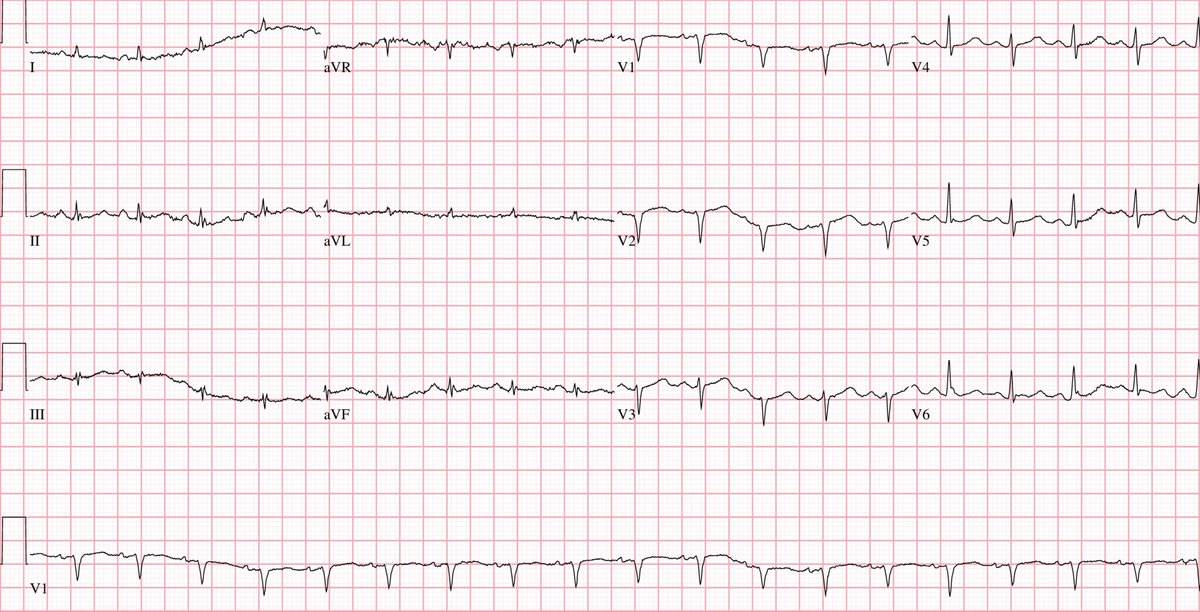 Sam Ghali, M.D. tweet media