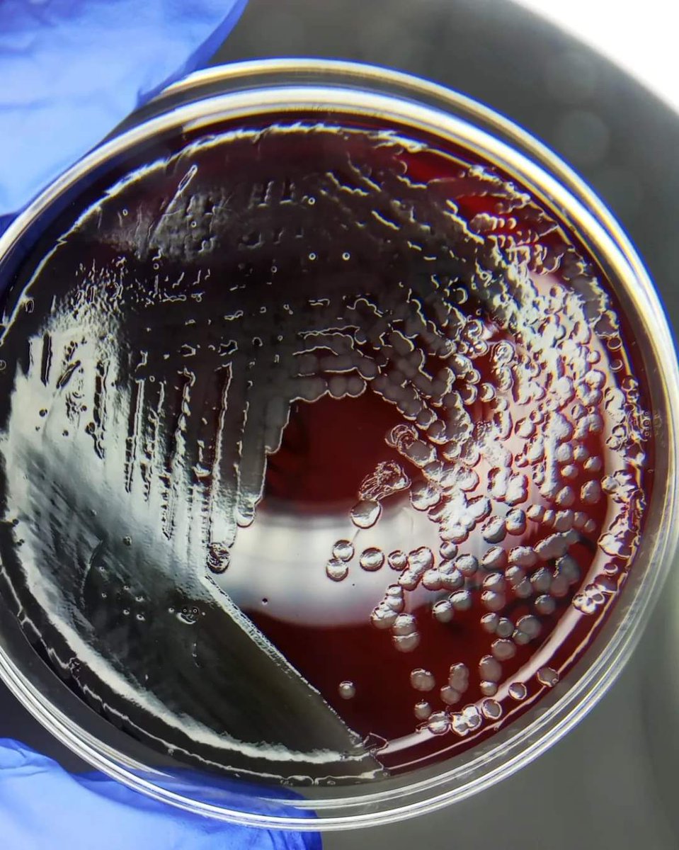 mICROBIOsh's tweet photo. 🚨Pseudomonas aeruginosa https://t.co/8SyAWcZBSz