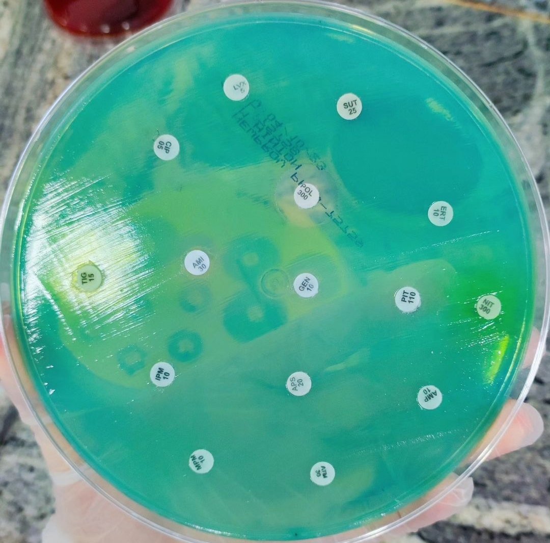 mICROBIOsh's tweet photo. 🚨Pseudomonas aeruginosa https://t.co/8SyAWcZBSz