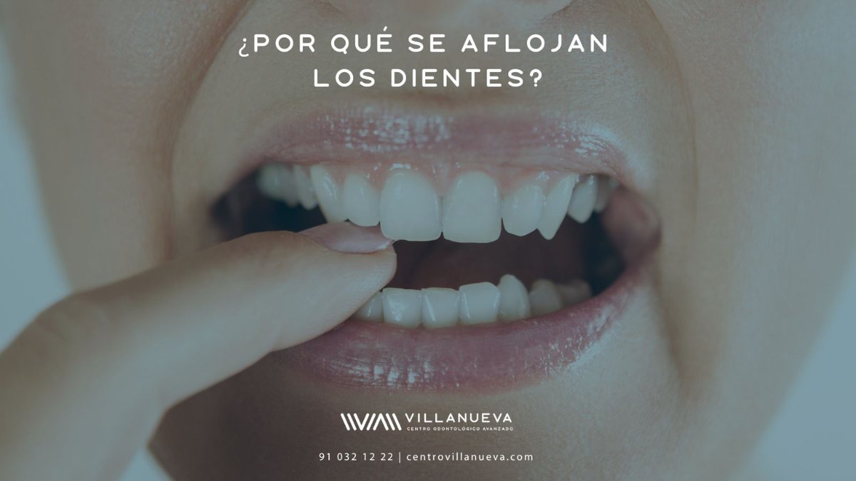 ctrovillanueva's tweet image. ▶️ Si sientes los dientes flojos es posible que haya algo que no funciona correctamente. Por ello en primer lugar es recomendable que le preguntes a tu dentista. 

centrovillanueva.com/por-que-diente…

#dientes #dientessaludables #dientessanos #saludoral #saludbucal #saludbucodental