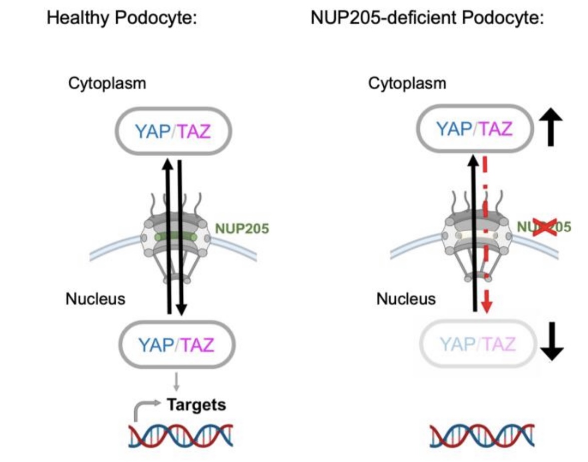 Bernhard Schermer (@bernhardscherm1) on Twitter photo 📢Thrilled to share: Our latest study on NUPs & the #Hippo regulators YAP/TAZ is now live <a href="/hmg_journal/">Human Molecular Genetics</a>. We add another puzzle piece to the role of YAP/TAZ in #Podocytes and #FSGS.
Congrats & a big THANK YOU to the entire team!
#nephrology #NephroLab
tinyurl.com/42e7jf4d 📢Thrilled to share: Our latest study on NUPs & the #Hippo regulators YAP/TAZ is now live <a href="/hmg_journal/">Human Molecular Genetics</a>. We add another puzzle piece to the role of YAP/TAZ in #Podocytes and #FSGS.
Congrats & a big THANK YOU to the entire team!
#nephrology #NephroLab
tinyurl.com/42e7jf4d