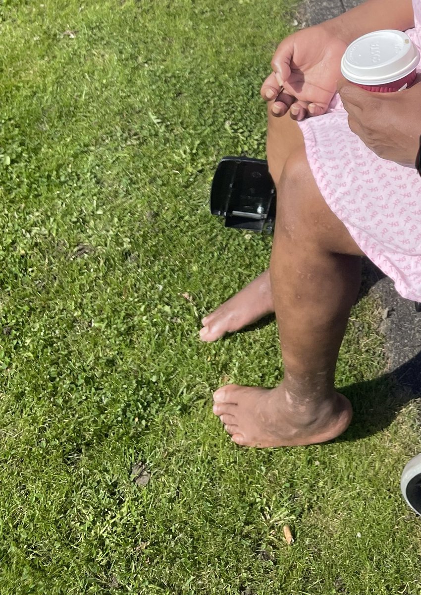 hulaspinner's tweet photo. My patient was disengaging in Therapy and looked really sad. She agreed to come for a coffee, so I took her off the ward. She opened up, despite her aphasia. Then I took her to feel the grass under her feet, she was all smiles. Small pleasures can go along way sometimes. https://t.co/RPaOLG4PHR