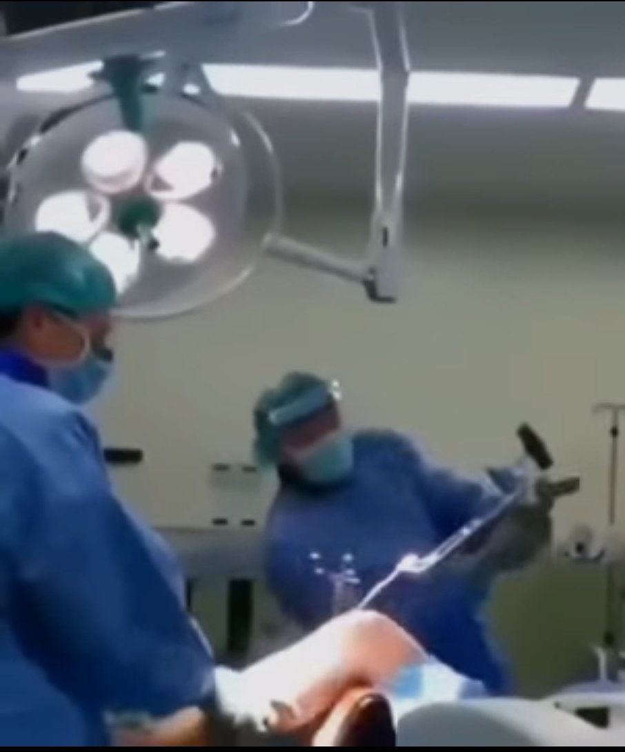 edivimo's tweet photo. @CapFuture_ @WokeArchive An ortophedic surgeon literally hammering a traction device screwed in the bone. https://t.co/exX8AnvyhP
