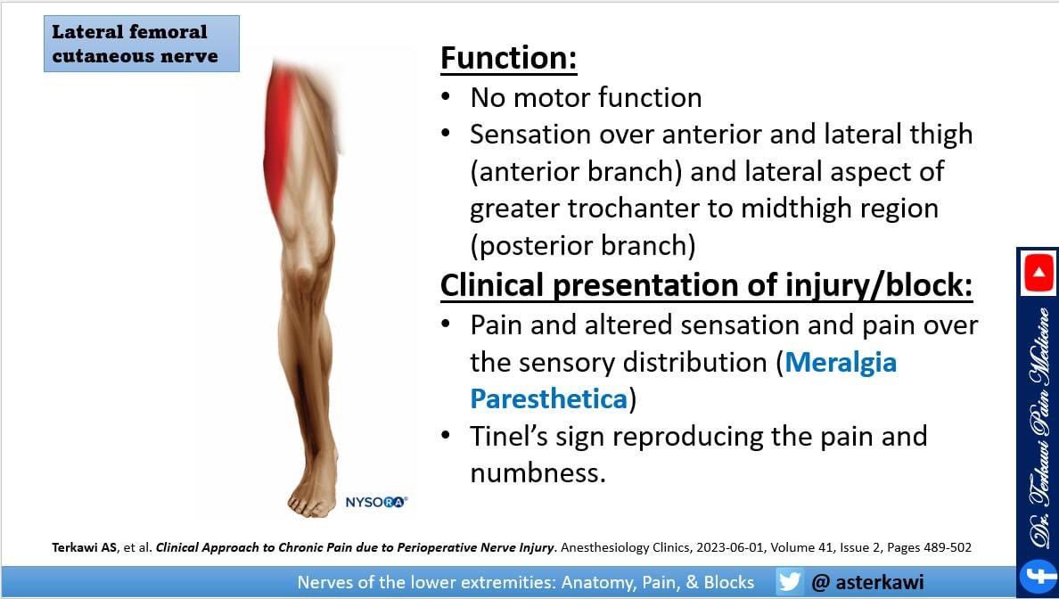 asterkawi's tweet photo. From my recent PNS course: Quick review for Lateral femoral cutaneous nerve (LFCN) anatomy, pain, and causes of injury.

Will publish the full lecture in my YouTube channel soon:  https://t.co/rqcRBzmCNA 

#chronicpain #Neuralgia #LFCN #Neuropathy #MeralgiaParesthetica https://t.co/qVJ47R7qUw