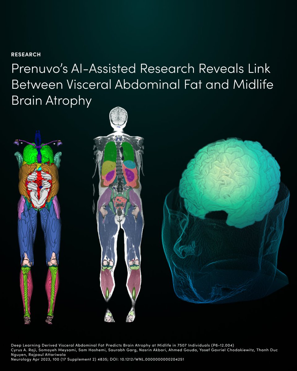 Uncovering a link between bellies and brain health, our AI-assisted research underscores the power of proactive screening and highlights the brain-body connection for well-being. 

Dive into our findings here: bit.ly/3QvFQib 

#Prenuvo #AAN #ProactiveCare