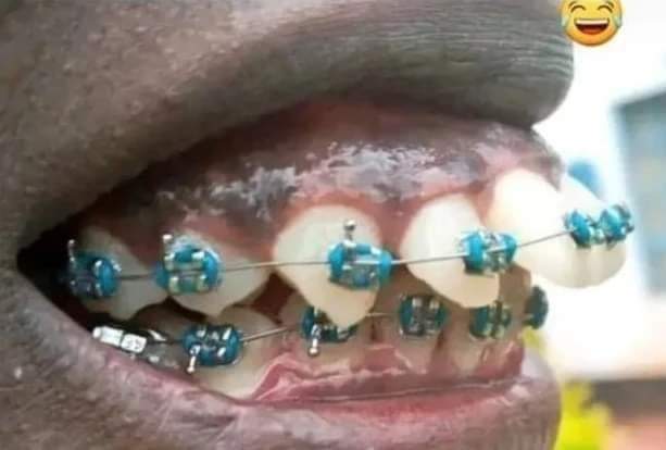 TheoUw1's tweet photo. Reka ndebe ko nanjye naseka muvandi🤣🤣🤣🤣 https://t.co/qukCeLET7v