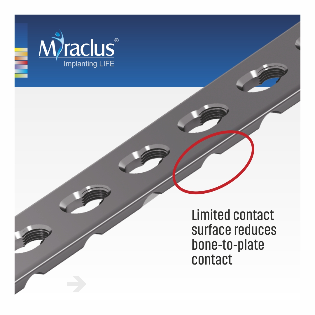 MiraclusOrtho's tweet image. The ingenious ASLP tibia plate implants comes with several benefits and aids in faster recovery of the shin bone.
Visit the below link for more information : 

miraclus.com/trauma/proxima…

#proximaltibia #miraclus #orthoimplants #orthopaedicsurgeon #india #surgicalimplants