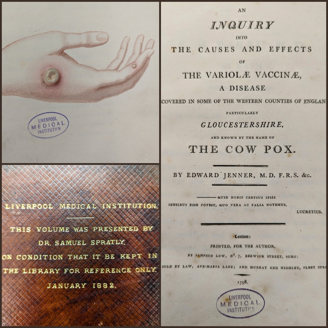 We are lucky to possess two copies of Edward Jenner's 1798 work in which he described the protective effect of cowpox against smallpox. Jenner’s vaccination soon became the major means of preventing smallpox around the world, and the disease was eventually eradicated in 1980.