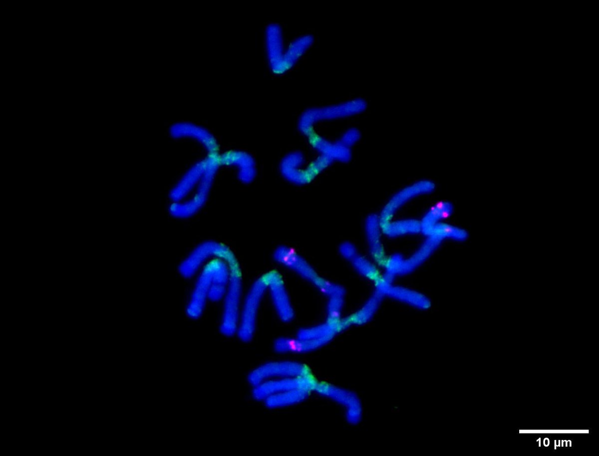 GihwanKim4's tweet photo. Crazy Chromosome World 🧬

Fluorescence In Situ Hybridization (FISH) shows clear pictures of chromosomes in Aegilops speltoides

This plant carries 3 B chromosomes

Probes:
Green: A-pericentromeric region
Magenta: B chromosome specific

#fish #fluorescencemicroscopy #cytogenetics https://t.co/fQsmiX2XKj