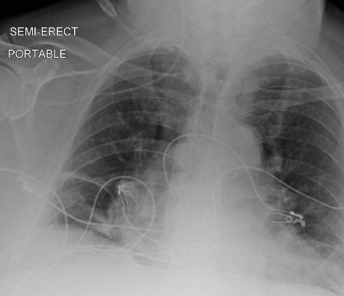 Hassan A. Raza tweet media