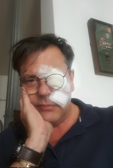 Si así quedó <a href="/DalmauFerrer/">Augusto Ferrer-Dalmau</a>, que es un chico duro, imaginen cómo debió de quedar el otro.