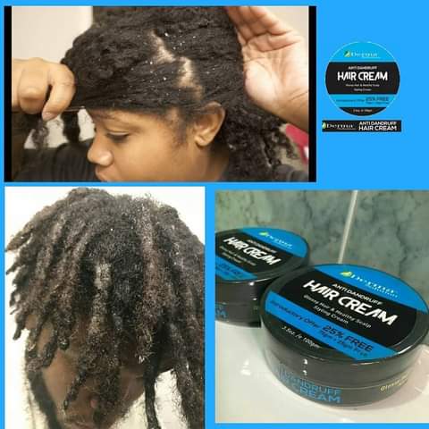 DermaSolutiongh's tweet photo. 2 for Ghc 60 p3✅️✅️

Anti-dandruff hair cream 

Treats dandruff and all scalp psoriasis

💯 effective

DM or Call 0205773069 

Kindly Retweet 🙏 

#Dermasolution
#Newsfile #Antidandruff https://t.co/FPo9qhcUd7