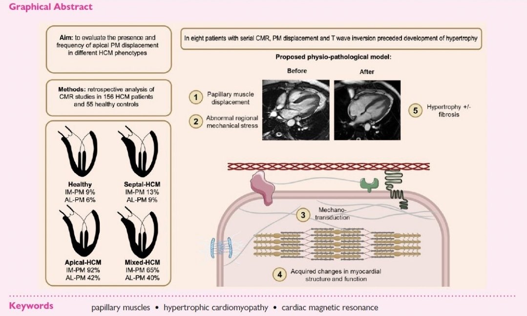 ⭐️ Apical papillary muscle displacement is a prevalent feature and a phenotypic precursor of apical hypertrophic cardiomyopathy.

✅️ It may even precede the development of hypertrophy

💡 There may be a a potential pathogenetic, mechanical link between both entities. 

Read the
