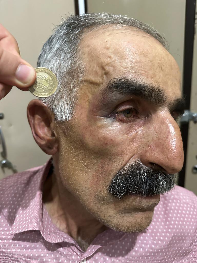 artigercek's tweet photo. Bitlis'te gözaltına alınan köylülerden Kerem Arvas darbedildi. Hastaneye kaldırılan Arvas, rapor alacak

https://t.co/iXVq8oXgMF https://t.co/dShnXmgWBj
