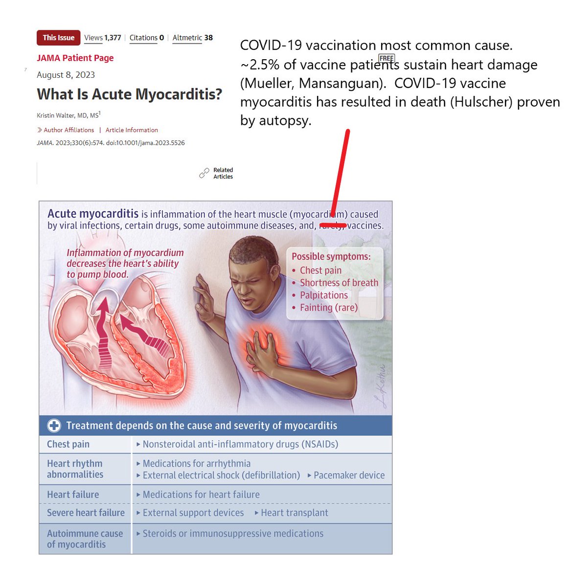 P_McCulloughMD's tweet photo. Myocarditis autopsy proven cause of death after C19vax.  Need immediate market removal of mRNA, risk stratification and mitigation programs to reduce the anticipated wave of sudden death.  @ACCinTouch @escardio @American_heart @franz_weidinger @HadleyWilsonMD @Joseph_C_Wu https://t.co/nHjByGIQea