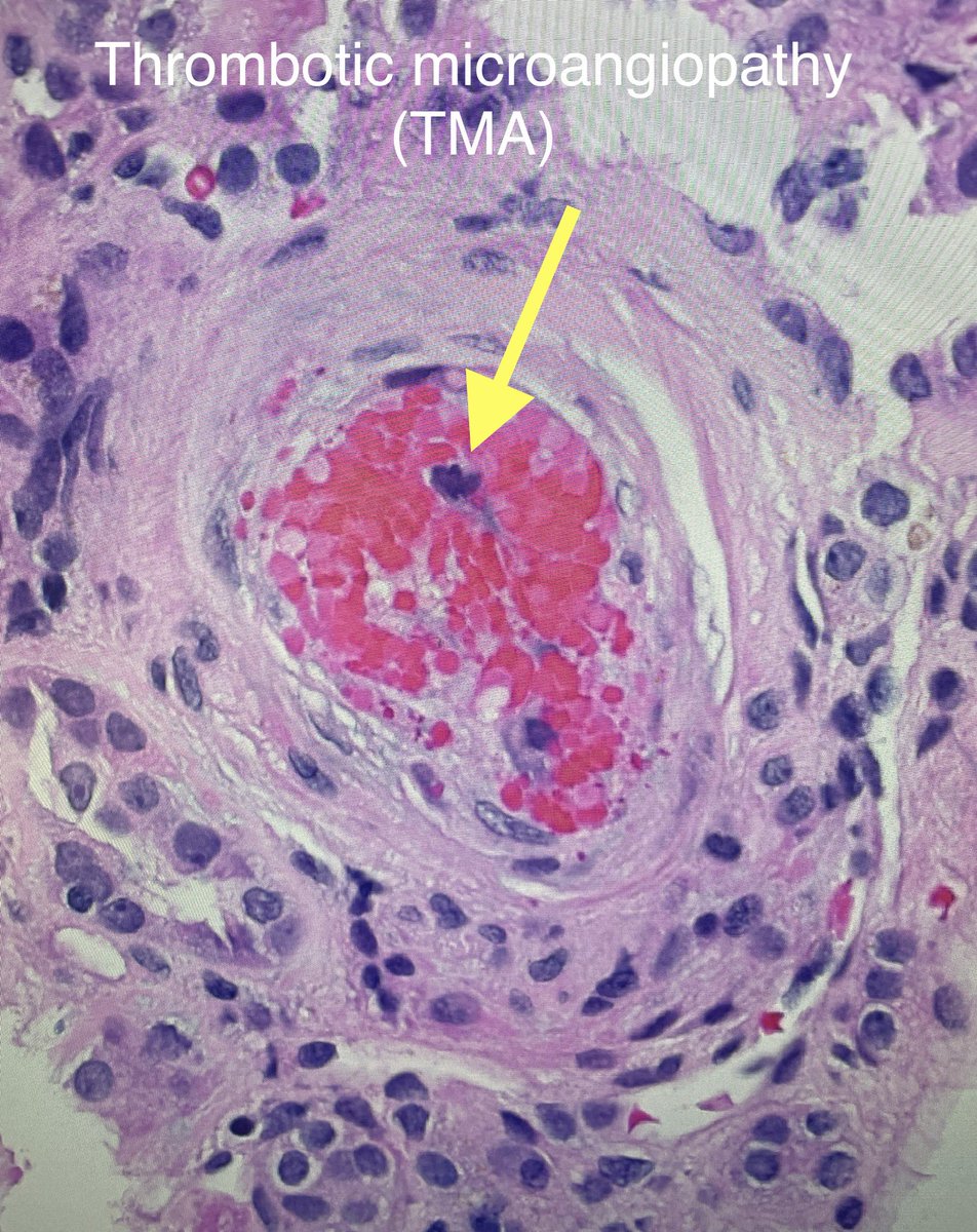 SethiRenalPath tweet picture