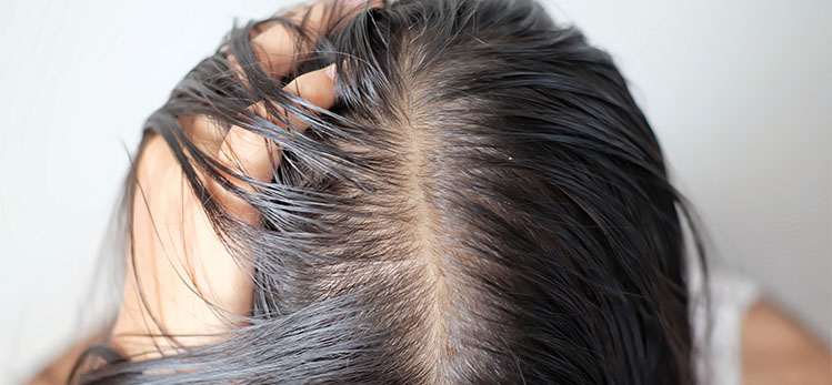 للتذكير العلاجات الي تفيد في التساقط الوراثي هي:
المينوكسديل 
حبوب فينسترايد 
حبوب دوتاستيرايد
حبوب سبايرونولاكتون

أشياء قد تعزز من نتيجة العلاجات السابقة:
الريجينيرا
البلازما
المكملات الغذائية
اكليل الجبل