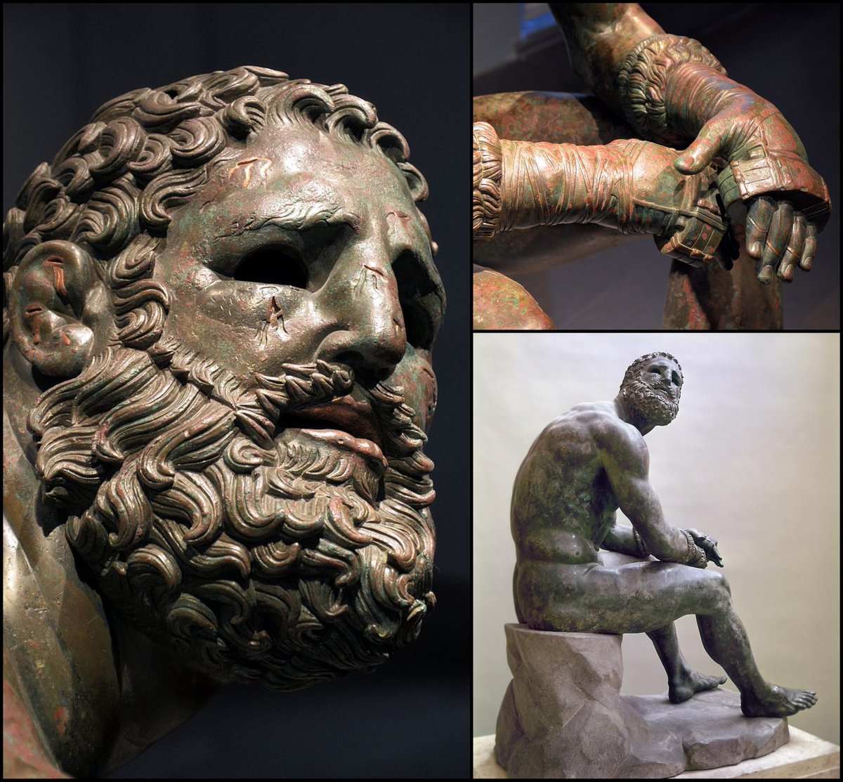 Not all ancient statues were about "ideal beauty".

The Resting Boxer, created over 2,000 years ago, is one of the most realistic sculptures ever made.

With a broken nose, cauliflower ears, scarred face, bruised eyes, and hand-wraps, it doesn't get any more intense than this....