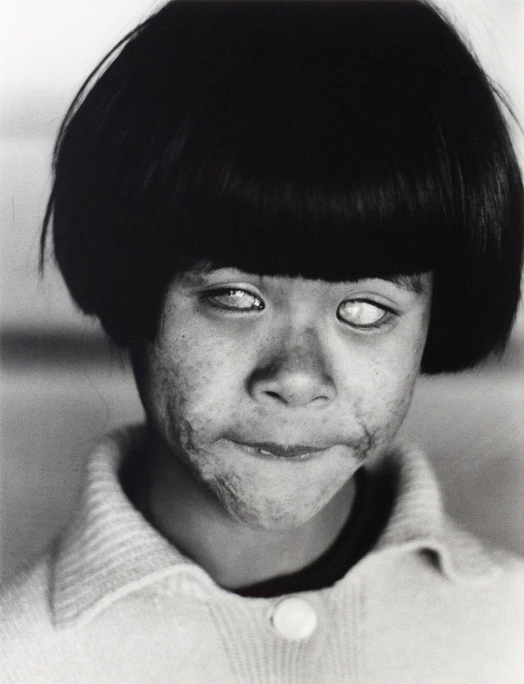 Witnessed in 1945, the eyes that beheld the world's end captured a poignant moment. A photograph depicts a young Japanese girl who lost her vision due to her presence during the atomic bombing of Hiroshima on August 6, 1945. This devastating event claimed the lives of more than