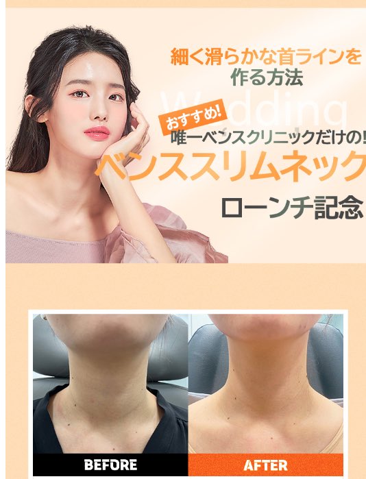 YOURCLINICJP's tweet photo. 日本語が通じれば #安心 でしょう？

日本語よく通じる韓国の病院はどこでしょうか？ 
日本語が可能な #医者 が週5-7日出勤の #ユアクリニック 弘大店
日本語対応のカウンセラーが常駐しています
安心して来てください

＃肩/ふくらはぎボト 100unit 3.9万₩

リツイートしておくと、8月以降も適用可能 https://t.co/ZkofkTtjOW