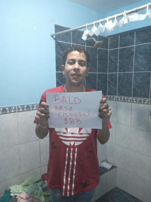 baldbaselol's tweet photo. Would you go $BALD for the current $BB payout ?
#BaldBase members are all shaving their heads and burning tokens.
New winner:
BURN:https://t.co/tDzd99EI2g
REWARD: https://t.co/YtVPg4gUNo https://t.co/WLIhBR8rJl